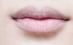 Dấu hiệu trên khuôn mặt cảnh báo dạ dày suy yếu